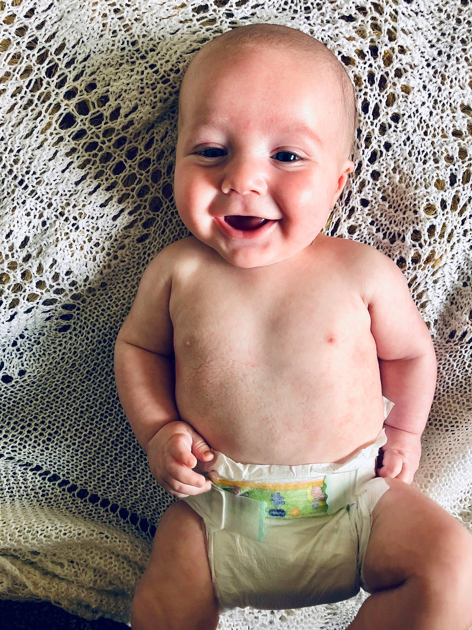 Stevie joined the competition — help win amazing prizes! baby, cheek, child, eye, face, head, joy, lip, mouth, nose, person, product, skin, smile, toddler