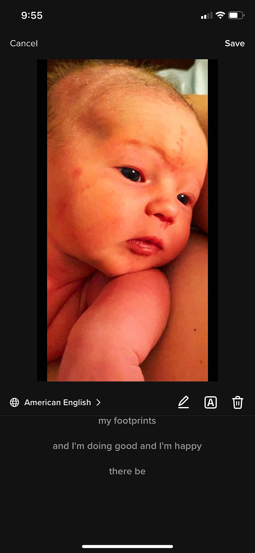 Elodie is registered to the contest to win money with this photo: abdomen, baby, cheek, chest, eyelash, flash_photography, flesh, gesture, hair, hand, happy, lip, nail, no_expression, nose, person, portrait_photography, stomach, thumb, toddler