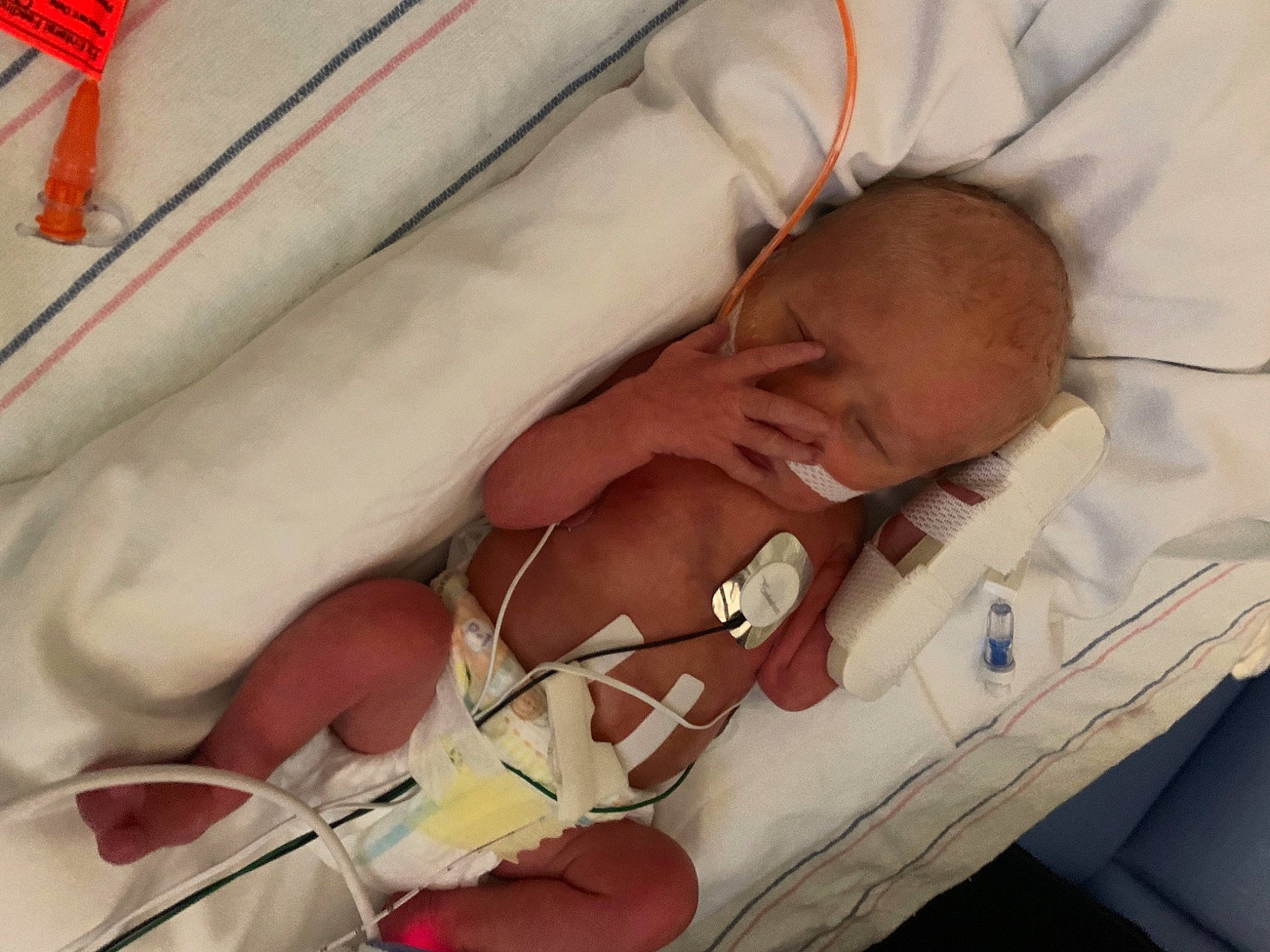 Everlee joined the competition — help win amazing prizes! baby, comfort, event, eyelash, finger, health_care, hospital, human_body, linens, medical, medical_equipment, medical_procedure, mouth, patient, pediatrics, person, service, skin, textile, thumb