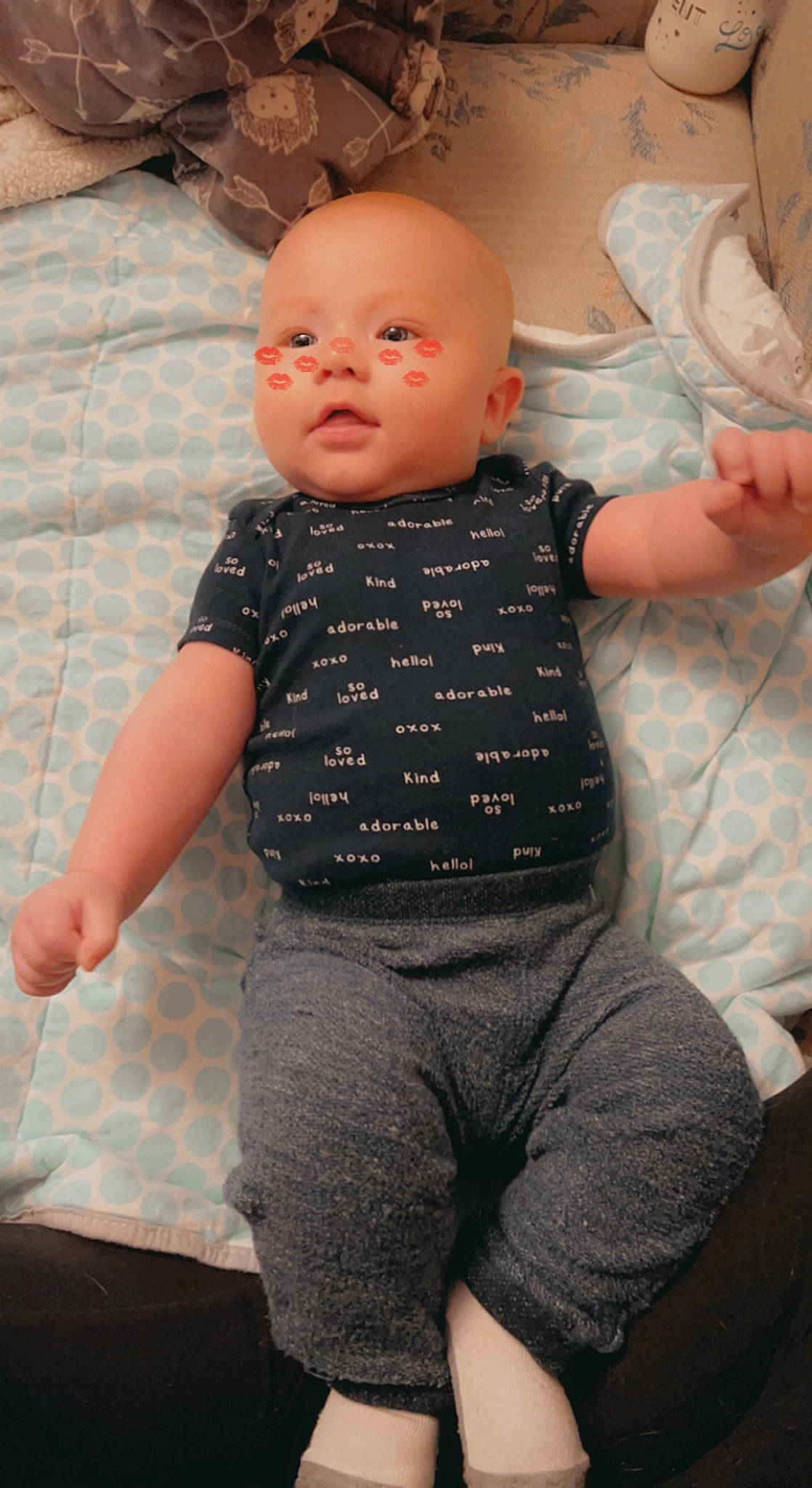 Walker joined the competition — help win amazing prizes! baby, baby_toddler_clothing, cheek, chin, comfort, eye, face, gesture, hand, head, human_body, joint, leg, lip, mouth, neck, nose, person, shoulder, skin