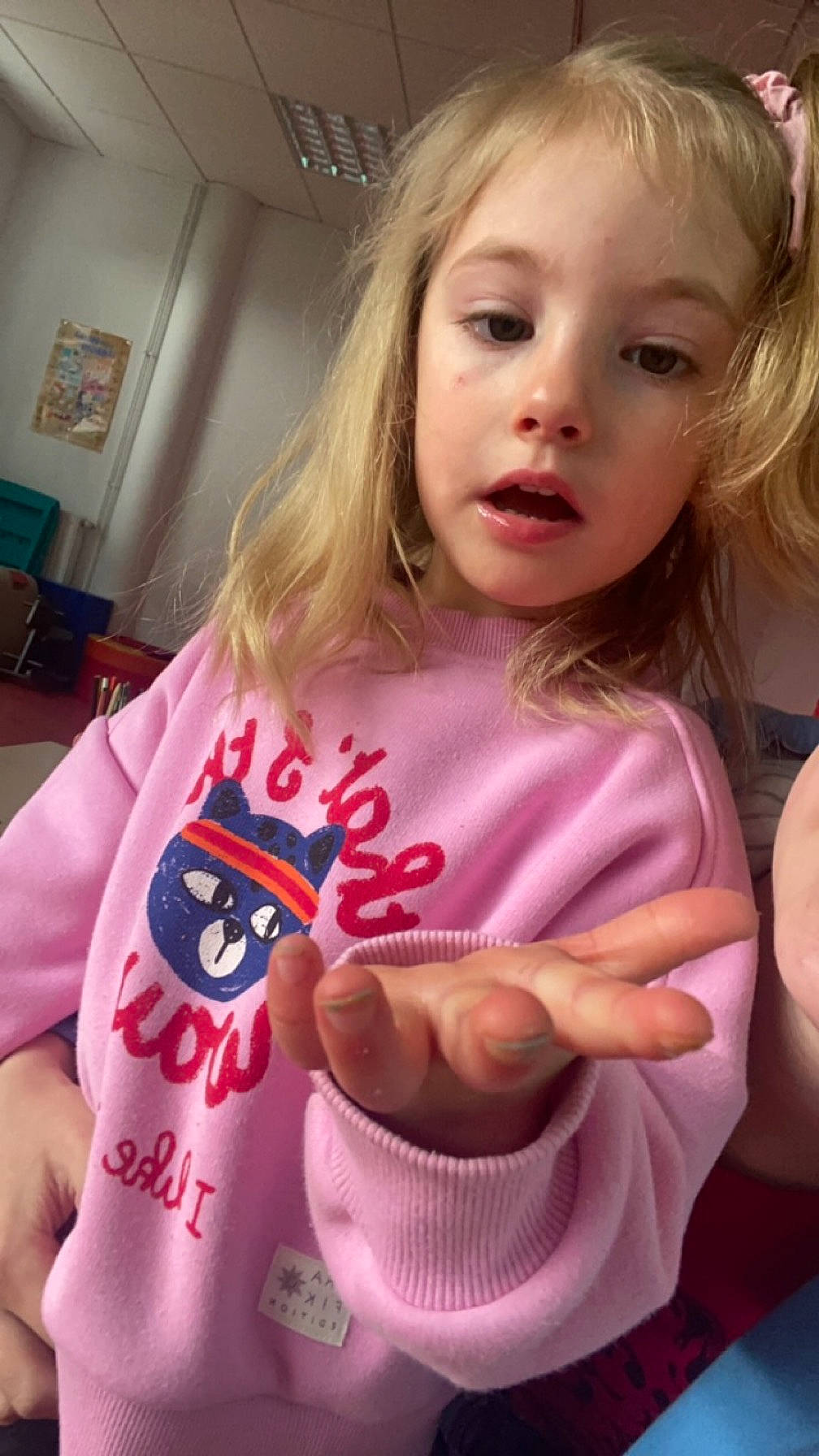 Lunaya participe au concours pour gagner de l'argent avec cette photo : cheek, chin, dress, ear, eye, eyelash, facial_expression, finger, hair, hairstyle, head, human_body, iris, lip, mouth, neck, nose, organ, person, pink