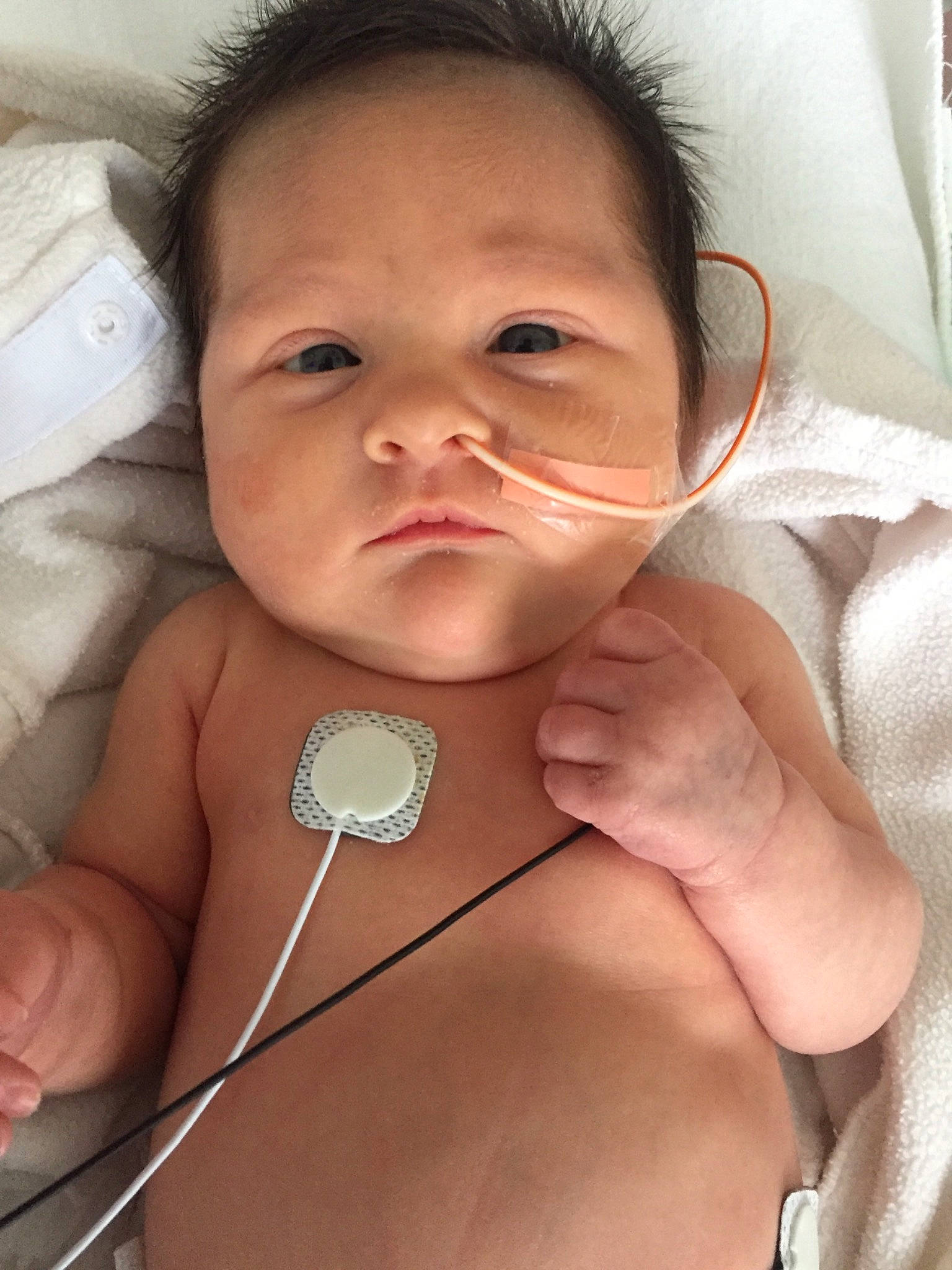 Lynlee is registered to the contest to win money with this photo: baby, cheek, chest, child, ear, face, finger, hand, head, hearing, lip, medical_equipment, muscle, neck, nose, person, skin, smile, stethoscope, thumb