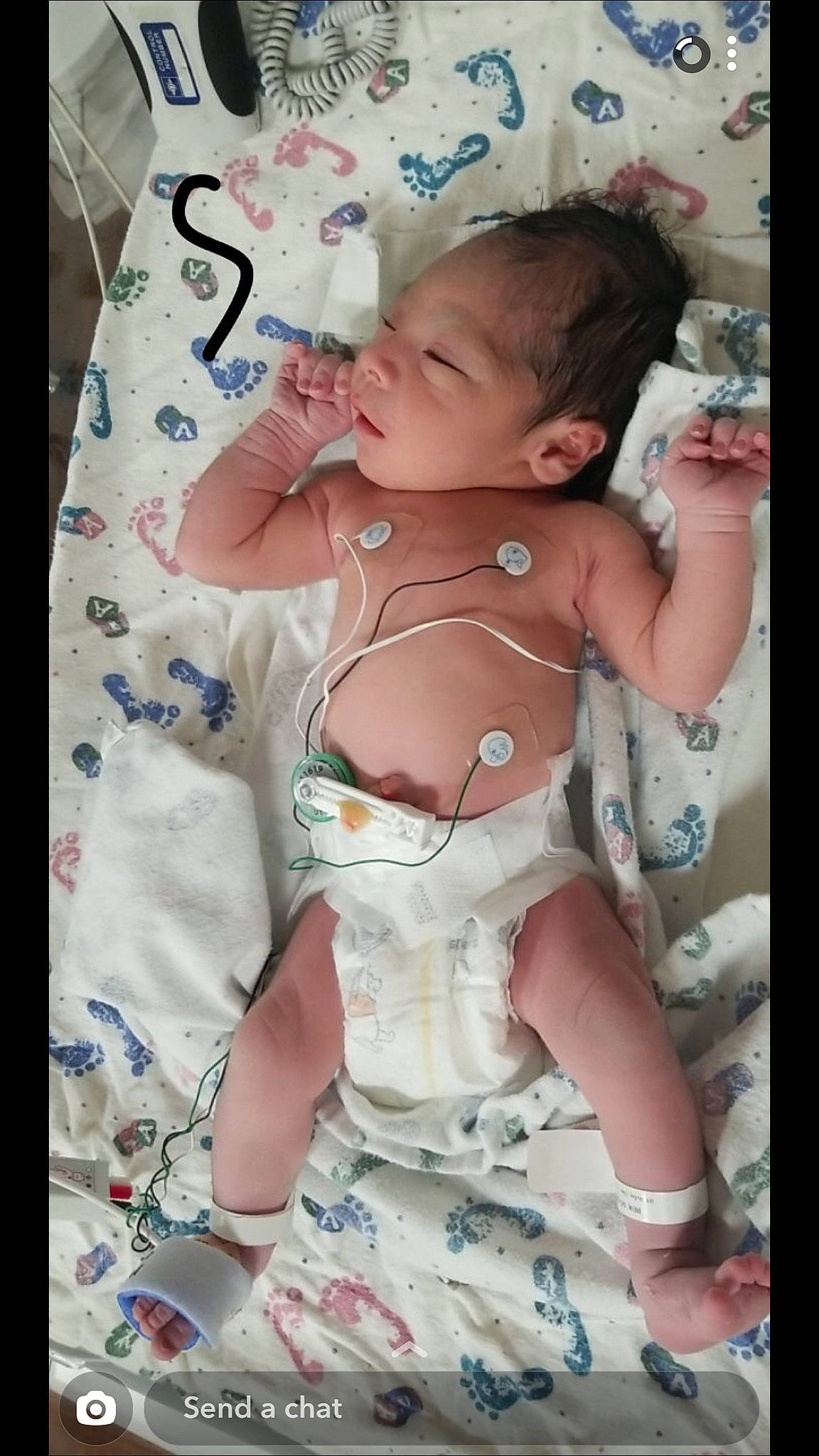 Mikael joined the competition — help win amazing prizes! baby, baby_products, baby_toddler_clothing, cheek, child, nose, person, product, skin, smile, toddler