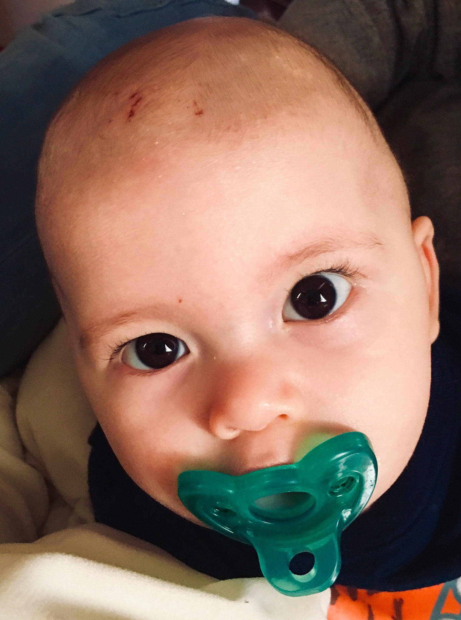 Bryer joined the competition — help win amazing prizes! baby, cheek, child, chin, ear, eye, eyelash, face, forehead, head, iris, lip, mouth, nose, person, toddler