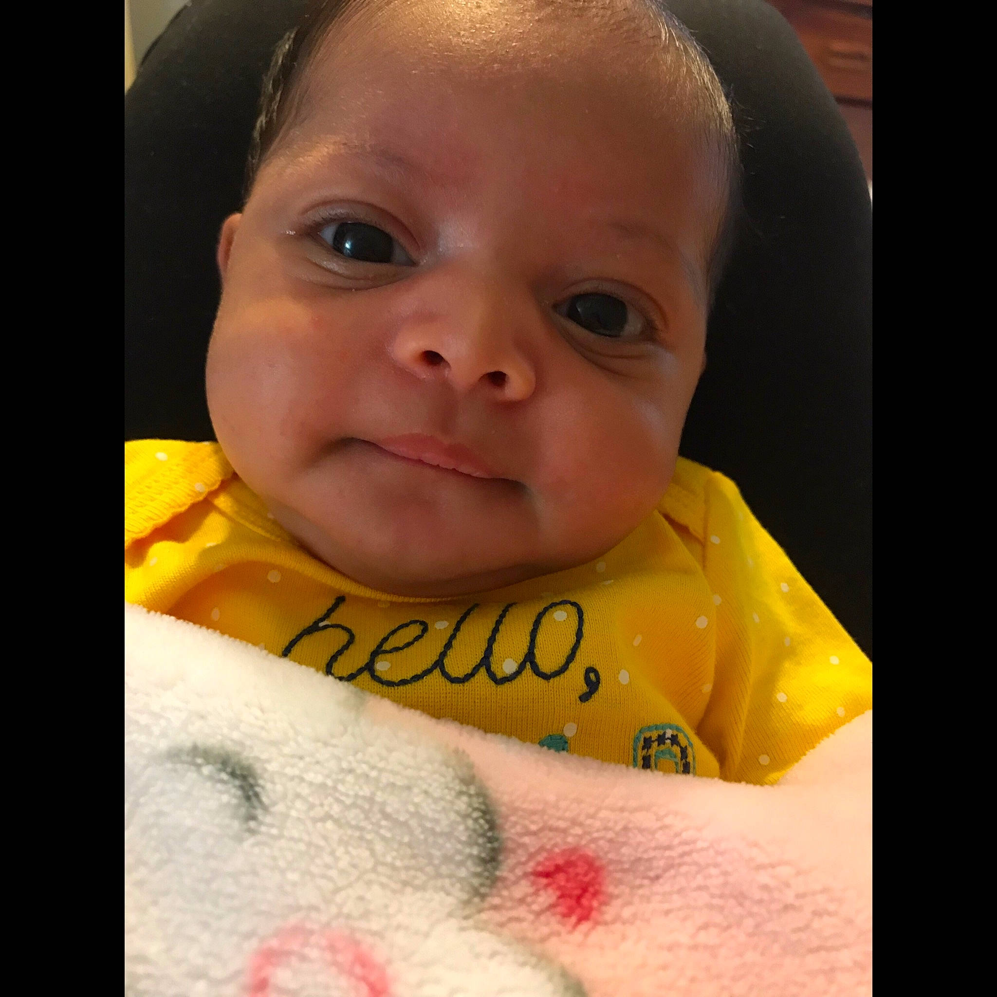 Myleigh joined the competition — help win amazing prizes! cheek, child, chin, close_up, eye, eyebrow, face, facial_expression, finger, forehead, head, infant, lip, mouth, nose, person, skin, smile, toddler, yellow