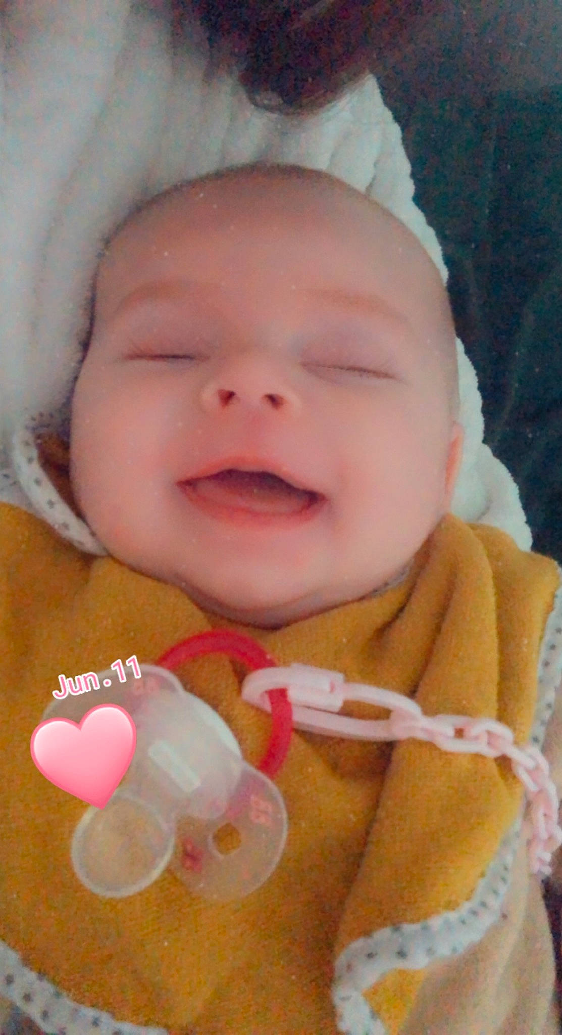 Angèle participe au concours pour gagner de l'argent avec cette photo : baby, baby_toddler_clothing, cheek, child, chin, eye, eyebrow, happy, head, human_body, iris, lip, mouth, nose, person, pink, skin, smile, textile, toddler