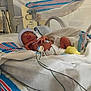 newborn, baby, hospital, incubator, blanket, medical_wires, hat, sock, monitoring, bed, infant, sleeping, patient, healthcare, nursery, tiny, wrapped, care, premature, peaceful