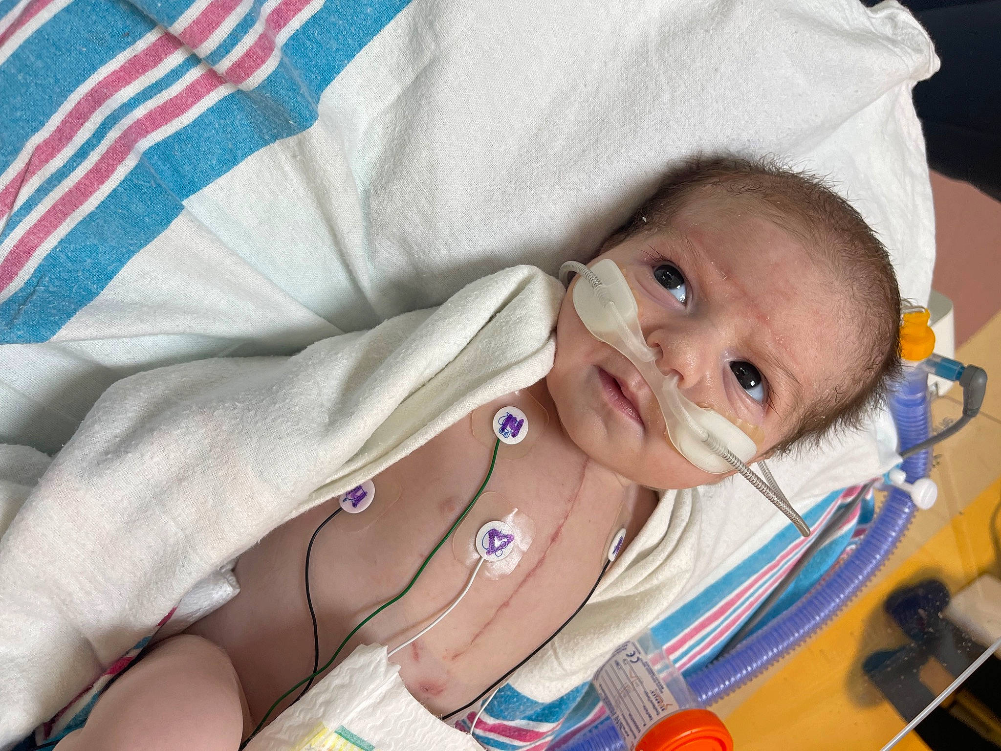 Ryan Jr is registered to the contest to win money with this photo: baby, baby_products, baby_safety, baby_toddler_clothing, cheek, child, comfort, eyebrow, eyelash, finger, health_care, linens, medical_equipment, nail, patient, person, service, skin, stethoscope, textile