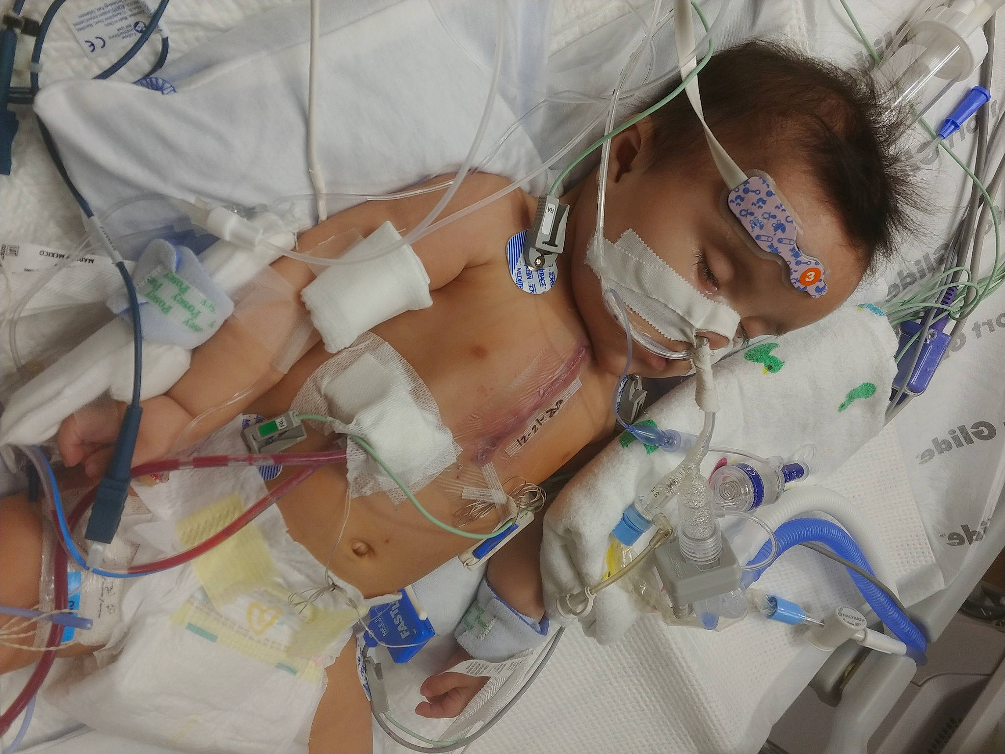 Ana is registered to the contest to win money with this photo: abdomen, chest, event, eyelash, eyewear, health_care, hospital, hospital_bed, human_leg, medical, medical_equipment, medical_procedure, patient, pattern, person, science, service, thigh, trunk, undergarment