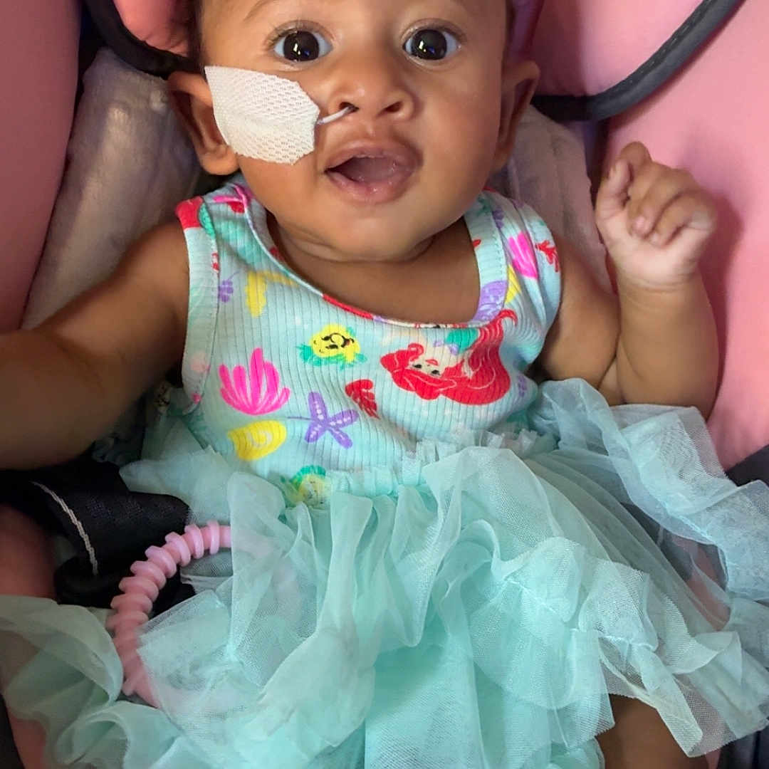 Naavya is registered to the contest to win money with this photo: baby, child, infant, tutu, dress, pink, seat, medical_tape, nasal_tube, curly_hair, wide_eyes, expression, cute, sitting, indoors, colorful_clothing, foot, hand, comfort, young