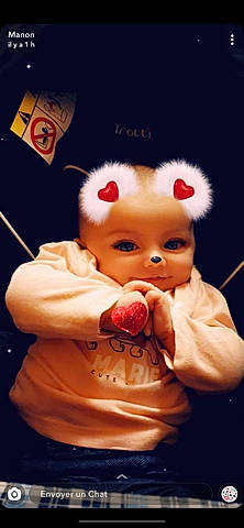 Léonie a rejoint le concours — aidez-le/la à gagner de superbes lots ! baby, cheek, child, ear, forehead, headwear, mouth, nose, person, photography, photomontage, toddler