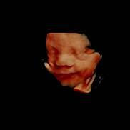 Kohen is registered to the contest to win money with this photo: ultrasound, 3d_ultrasound, baby, fetus, prenatal, face, medical_image, pregnancy, womb, embryo, scan, healthcare, soft_tones, black_background, peaceful, newborn, gestation, human, development, life