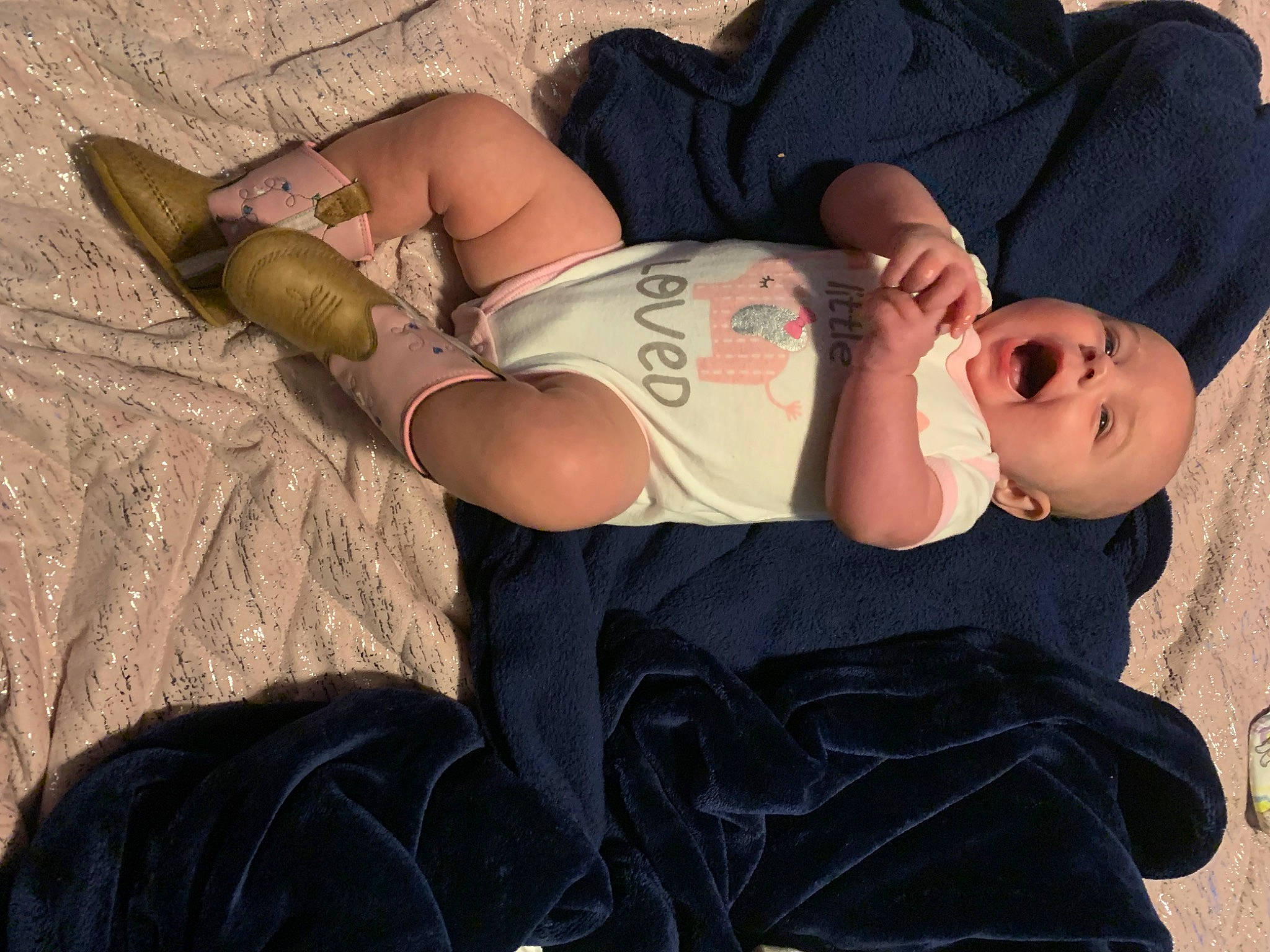 Fallon joined the competition — help win amazing prizes! abdomen, black_hair, comfort, elbow, eyewear, glasses, grass, hand, hat, human_leg, joint, knee, landscape, leg, person, sitting, sunglasses, tattoo, thigh, tree