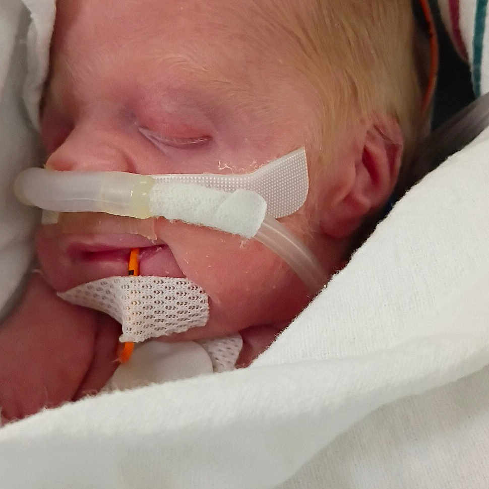 Josephine joined the competition — help win amazing prizes! newborn, baby, infant, sleeping, hospital, medical_equipment, nasal_tube, tubing, blanket, swaddled, portrait, face, closed_eyes, fair_hair, bed, healthcare, premature_infant, indoors, peaceful, photograph