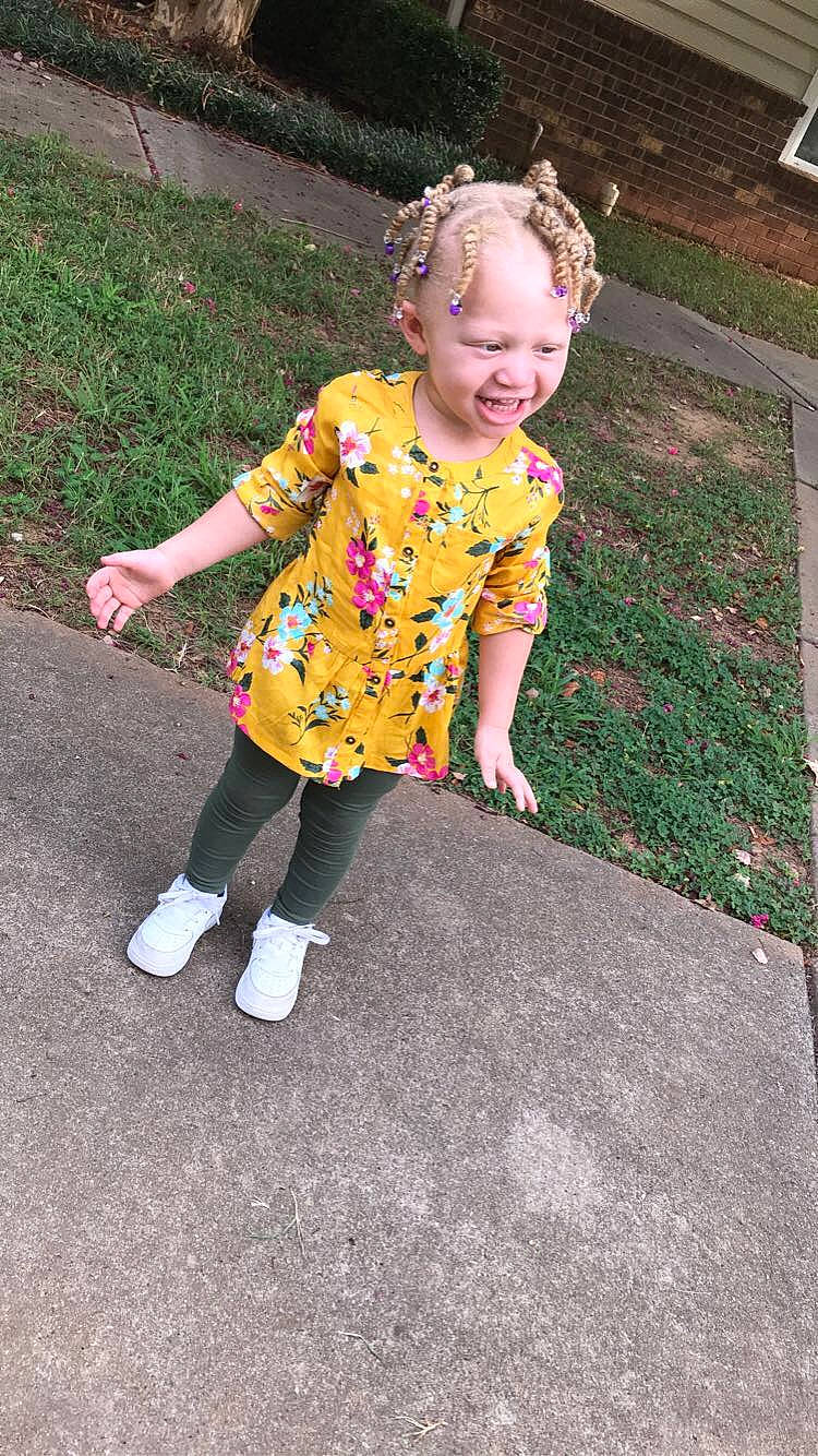 Heaven joined the competition — help win amazing prizes! child, dress, fawn, fun, grass, pattern, person, plant, play, shoe, smile, summer, toddler, vacation, yellow