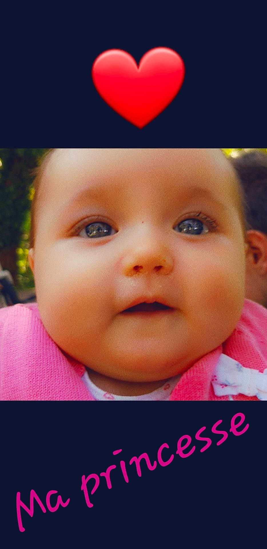 Alyana a rejoint le concours — aidez-le/la à gagner de superbes lots ! baby, baby_making_funny_faces, cheek, child, chin, close_up, eye, eyebrow, face, facial_expression, forehead, head, lip, mouth, nose, person, photo_caption, pink, skin, smile