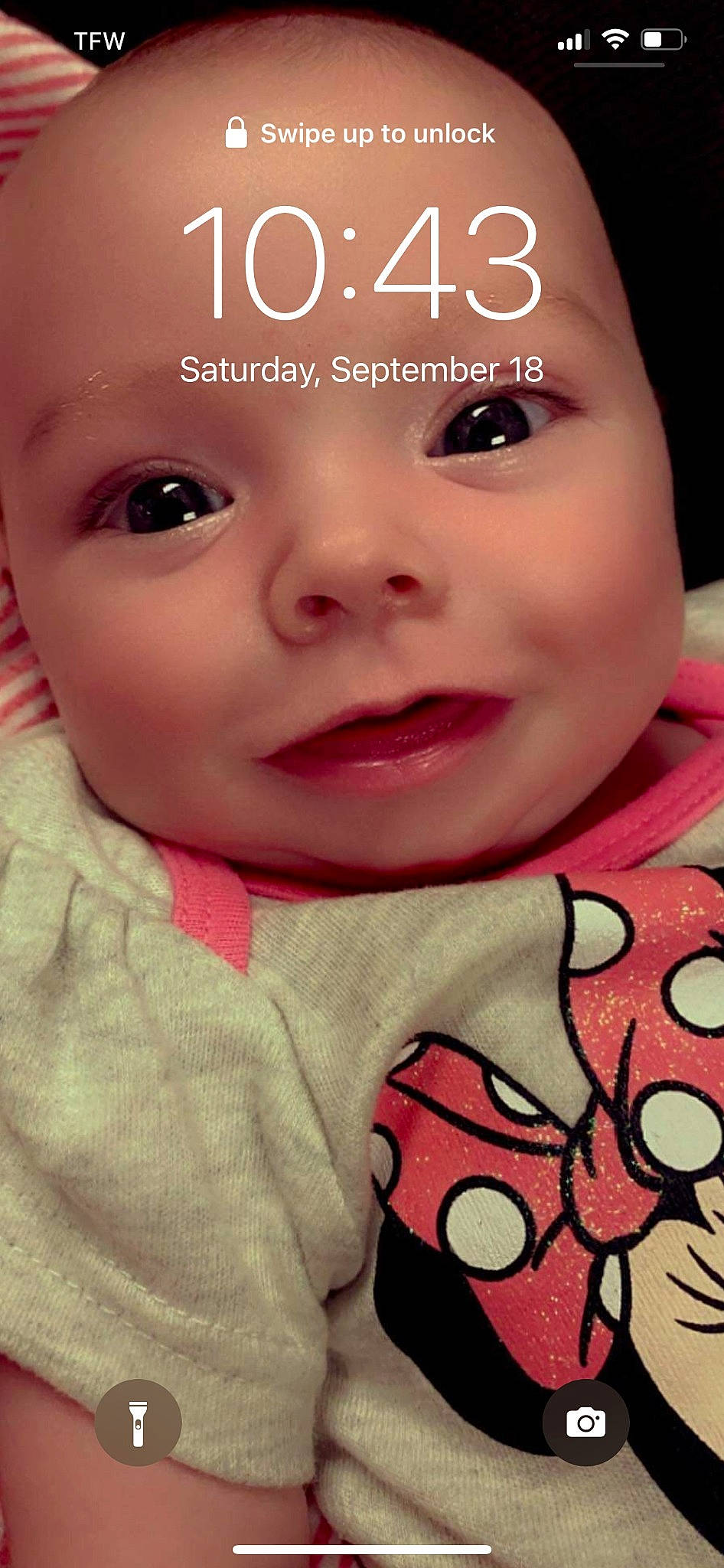 Aviana is registered to the contest to win money with this photo: baby, baby_toddler_clothing, cheek, chin, eye, eyelash, face, facial_expression, finger, hand, iris, lip, mouth, neck, nose, organ, person, pink, product, skin