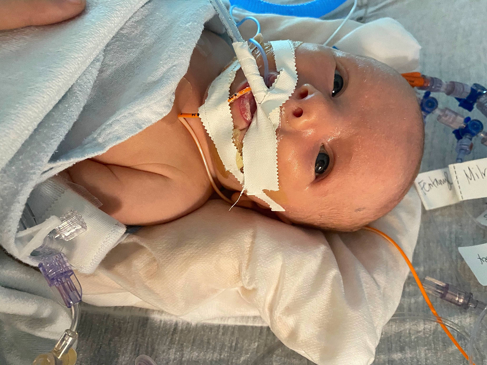 Flynn is registered to the contest to win money with this photo: baby, birth, child, nose, person