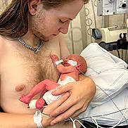 Benny is registered to the contest to win money with this photo: baby, premature_baby, hospital, medical_equipment, tubes, young_adult, shirtless, holding, cradling, love, care, bed, pillow, diaper, necklace, hair, skin, hand, person, intensive_care