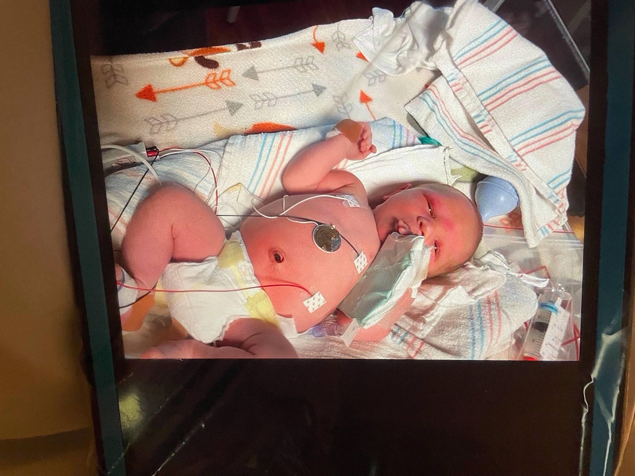 Huntley joined the competition — help win amazing prizes! abdomen, baby, baby_products, carmine, chest, child, comfort_food, cuisine, display_device, drawer, flesh, human_leg, packing_materials, pattern, peach, person, room, service, thigh, toddler