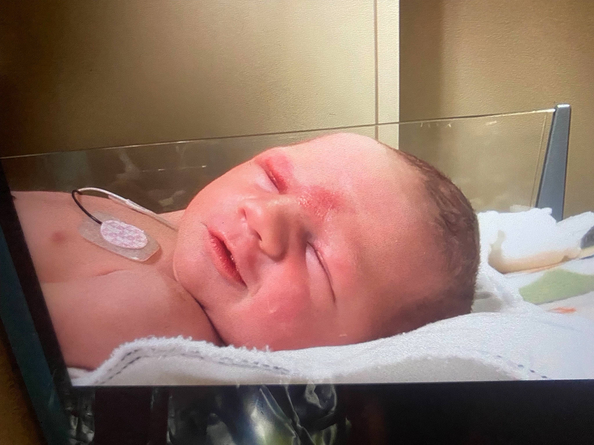 Huntley is registered to the contest to win money with this photo: arm, baby, cheek, chest, chin, comfort, ear, eye, eyebrow, eyelash, hair, hand, head, jaw, lip, medical, medical_equipment, neck, nose, patient