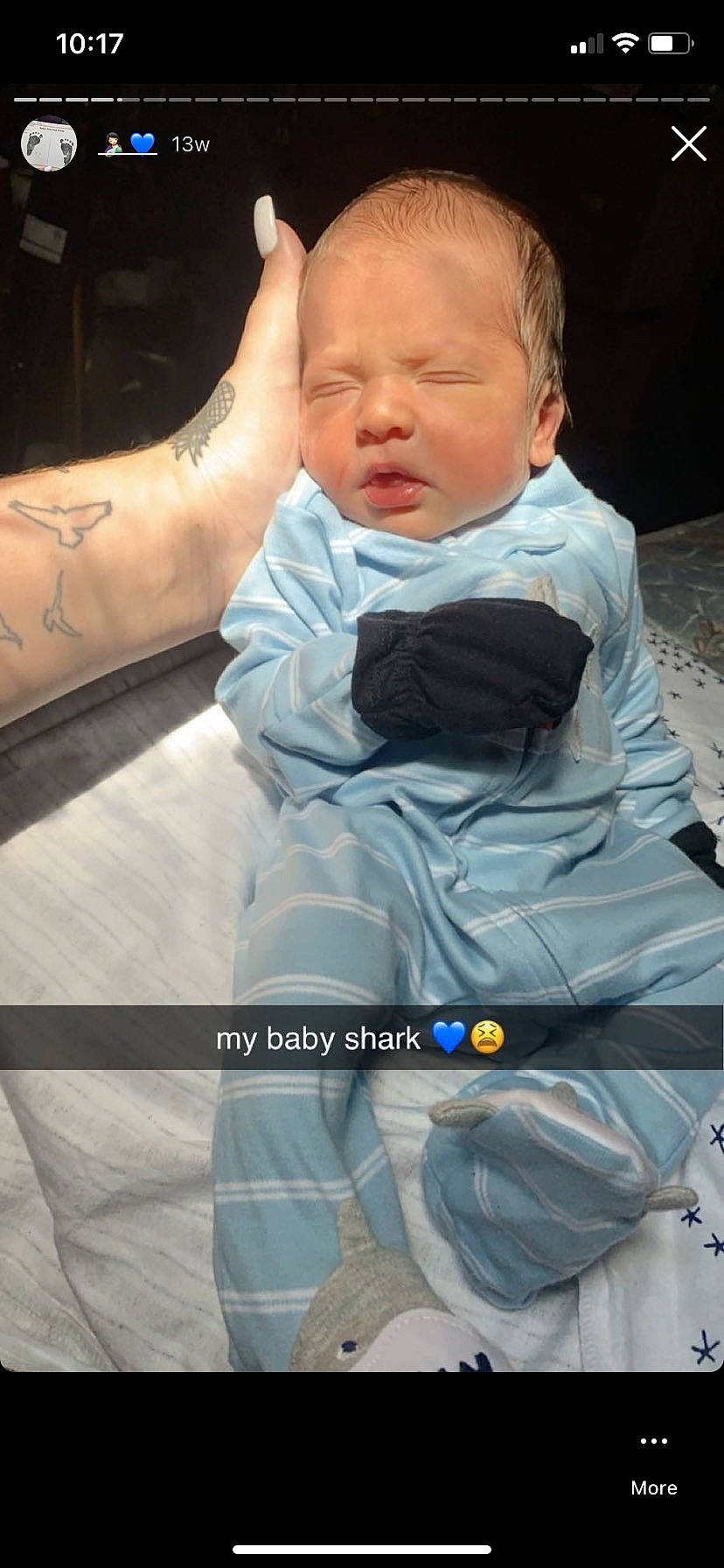 Kirby joined the competition — help win amazing prizes! arm, baby, cheek, child, hand, head, human, nose, person, product, sorrow, toddler