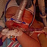 baby, medical_equipment, oxygen_tube, iv_line, hospital_blanket, sleeping, infant, close_up, face, hand, healthcare, patient, care, newborn, child, hospital, medical_care, respirator, tubes, rest