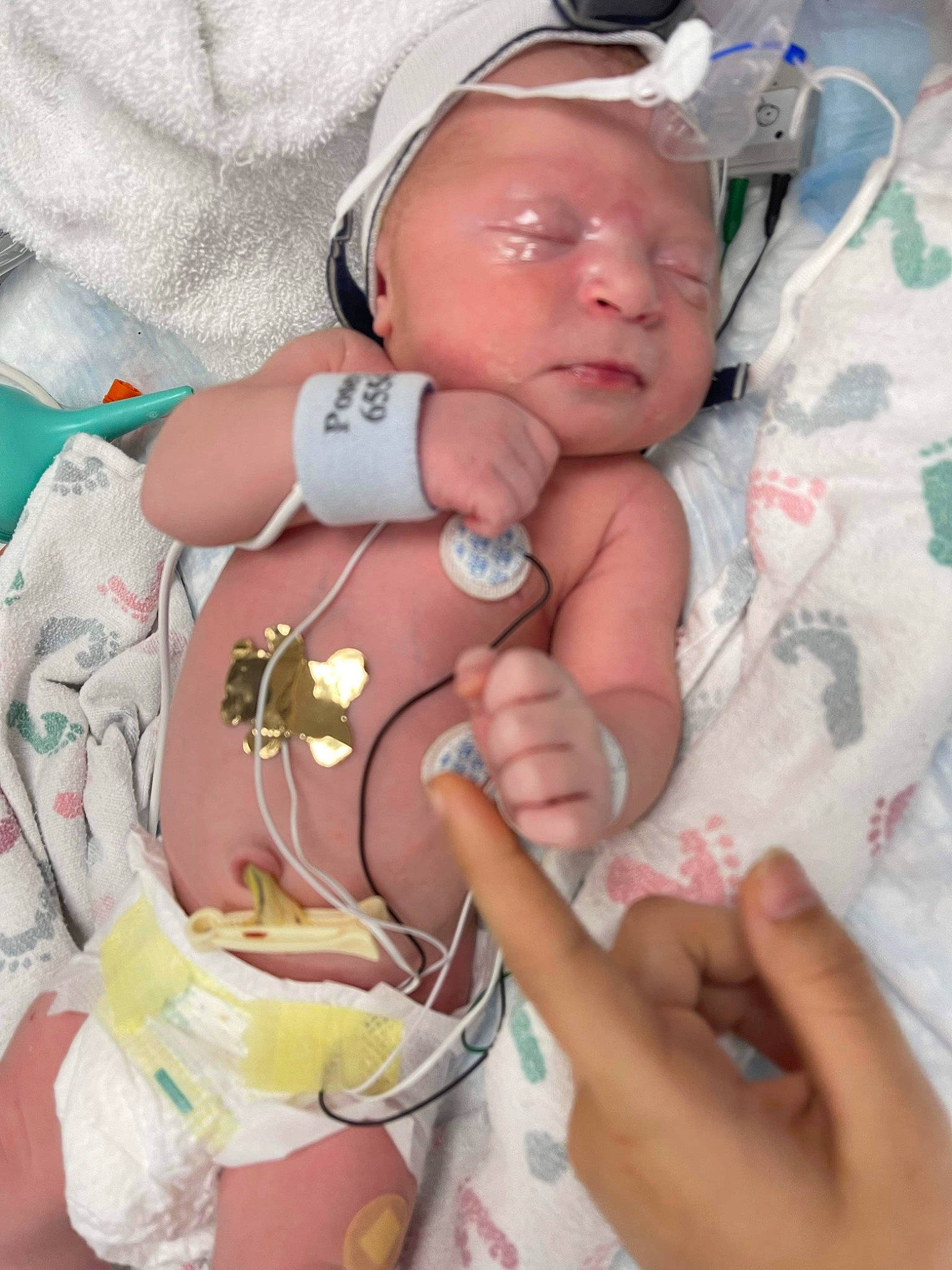 Cattleya is registered to the contest to win money with this photo: baby, eyelash, finger, hand, hat, headwear, health_care, health_care_provider, hospital, hospital_bed, medical, medical_equipment, medical_procedure, mouth, patient, pediatrics, person, service, skin, stethoscope