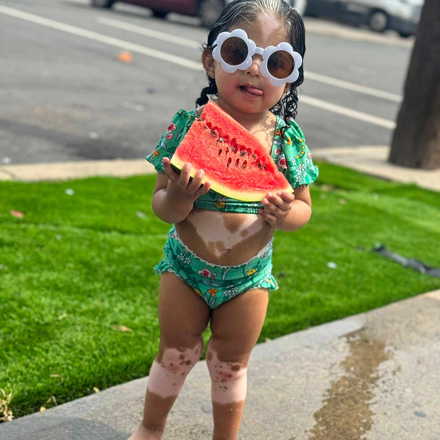 Júlia is registered to the contest to win money with this photo: barefoot, child, cute, daytime, food, fruit, fun, grass, green_swimsuit, outdoor, playful, sidewalk, standing, street, summer, sunglasses, sunny, toddler, vitiligo, watermelon