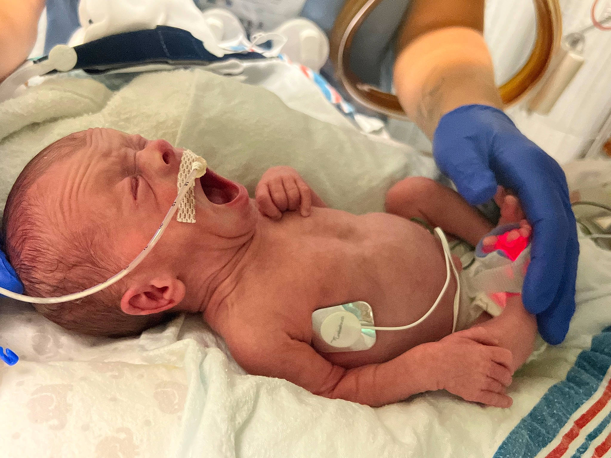 Malakai is registered to the contest to win money with this photo: abdomen, baby, chest, child, comfort, event, glasses, health_care, hospital, linens, medical, medical_equipment, medical_procedure, mouth, patient, person, room, service, skin, toddler