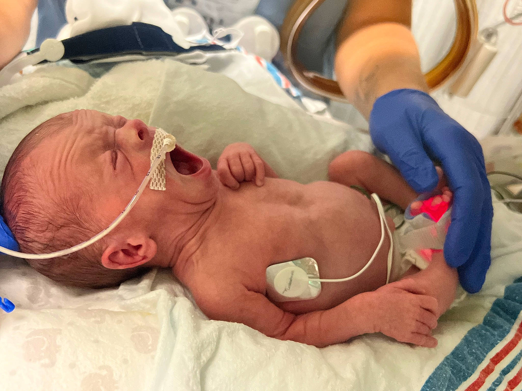 Malakai joined the competition — help win amazing prizes! abdomen, baby, chest, child, comfort, finger, glasses, hand, health_care, hospital, joint, medical, medical_equipment, medical_procedure, mouth, patient, pediatrics, person, service, skin