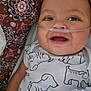 Enoch is registered to the contest to win money with this photo: baby, infant, smile, oxygen_tube, onesie, dog_print, patterned_fabric, lying_down, happy, child, cute, face, skin, hand, textile, healthcare, closeup, person, indoors, young