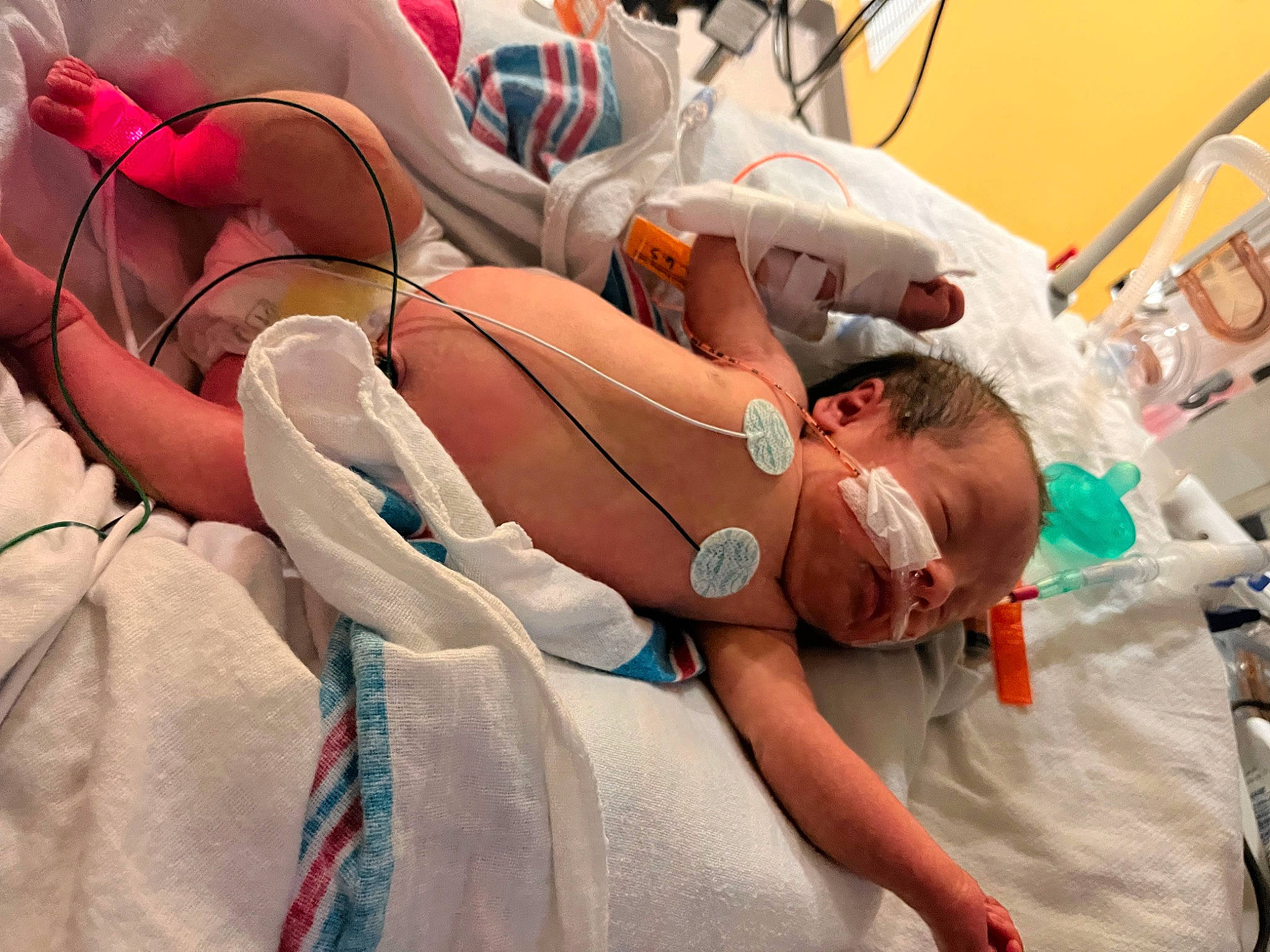 Flora is registered to the contest to win money with this photo: abdomen, chest, child, comfort, event, flesh, fun, hat, health_care, hospital, hospital_bed, leisure, medical, medical_equipment, medical_procedure, patient, person, personal_protective_equipment, room, service