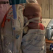 Zadie is registered to the contest to win money with this photo: abdomen, baby, baby_carriage, baby_products, baby_safety, baby_toddler_clothing, chest, child, comfort, health_care, hospital, infant_bed, linens, medical, medical_equipment, personal_protective_equipment, service, sunglasses, thumb, toddler