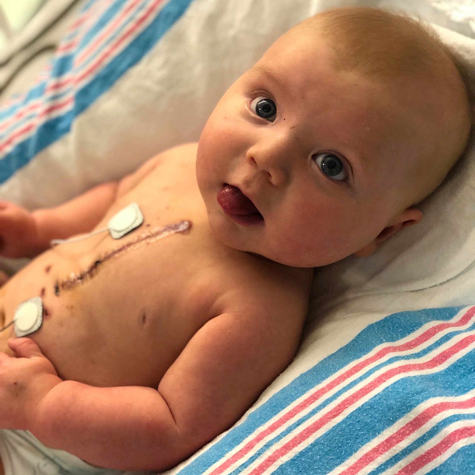 Dante is registered to the contest to win money with this photo: baby, birth, cheek, child, chin, eye, face, head, lip, mouth, muscle, nose, person, skin, smile, toddler