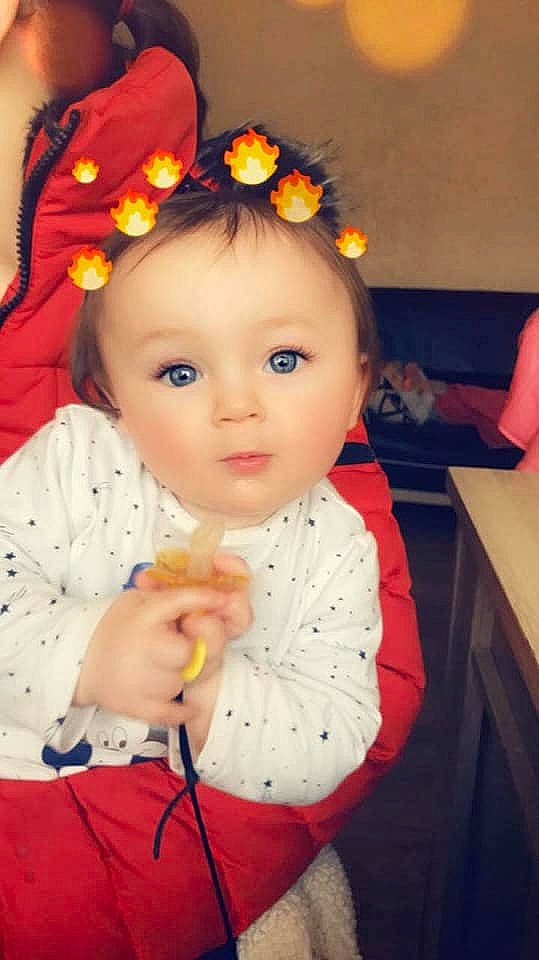 Leo a rejoint le concours — aidez-le/la à gagner de superbes lots ! cheek, child, day, eye, fun, girl, hair_accessory, happiness, head, human_hair_color, infant, iris, person, product, skin, smile, textile, toddler, yellow