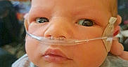 Lucas is registered to the contest to win money with this photo: baby, infant, face, oxygen_tube, nasal_cannula, clothing, onesie, animal_print, indoor, portrait, child, person, newborn, cute, serious_expression, healthcare, medical, close_up, head, skin
