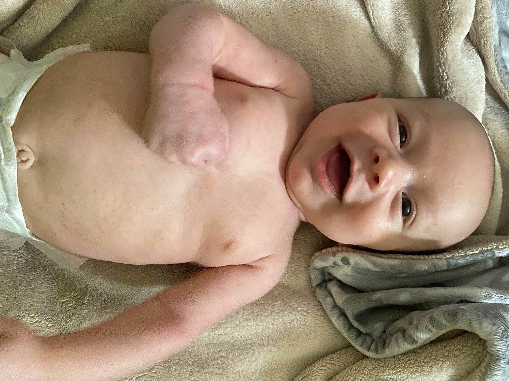 Amias joined the competition — help win amazing prizes! abdomen, arm, baby, cheek, chest, child, comfort, eye, eyebrow, gesture, head, human_body, linens, lip, mouth, nose, person, skin, smile, toddler