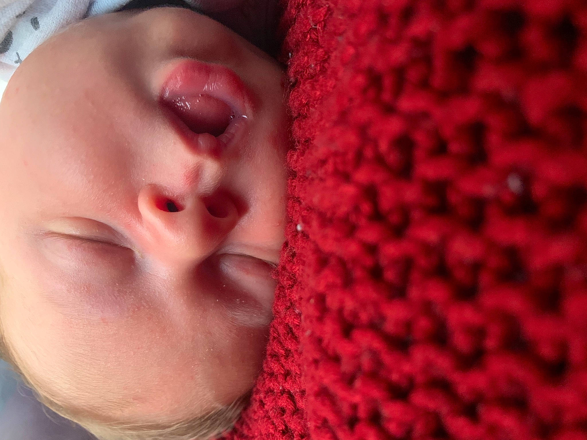 Mathias joined the competition — help win amazing prizes! baby, baby_sleeping, cheek, chin, eye, eyebrow, eyelash, facial_expression, finger, forehead, hand, head, headgear, lip, mouth, neck, nose, person, pink, skin