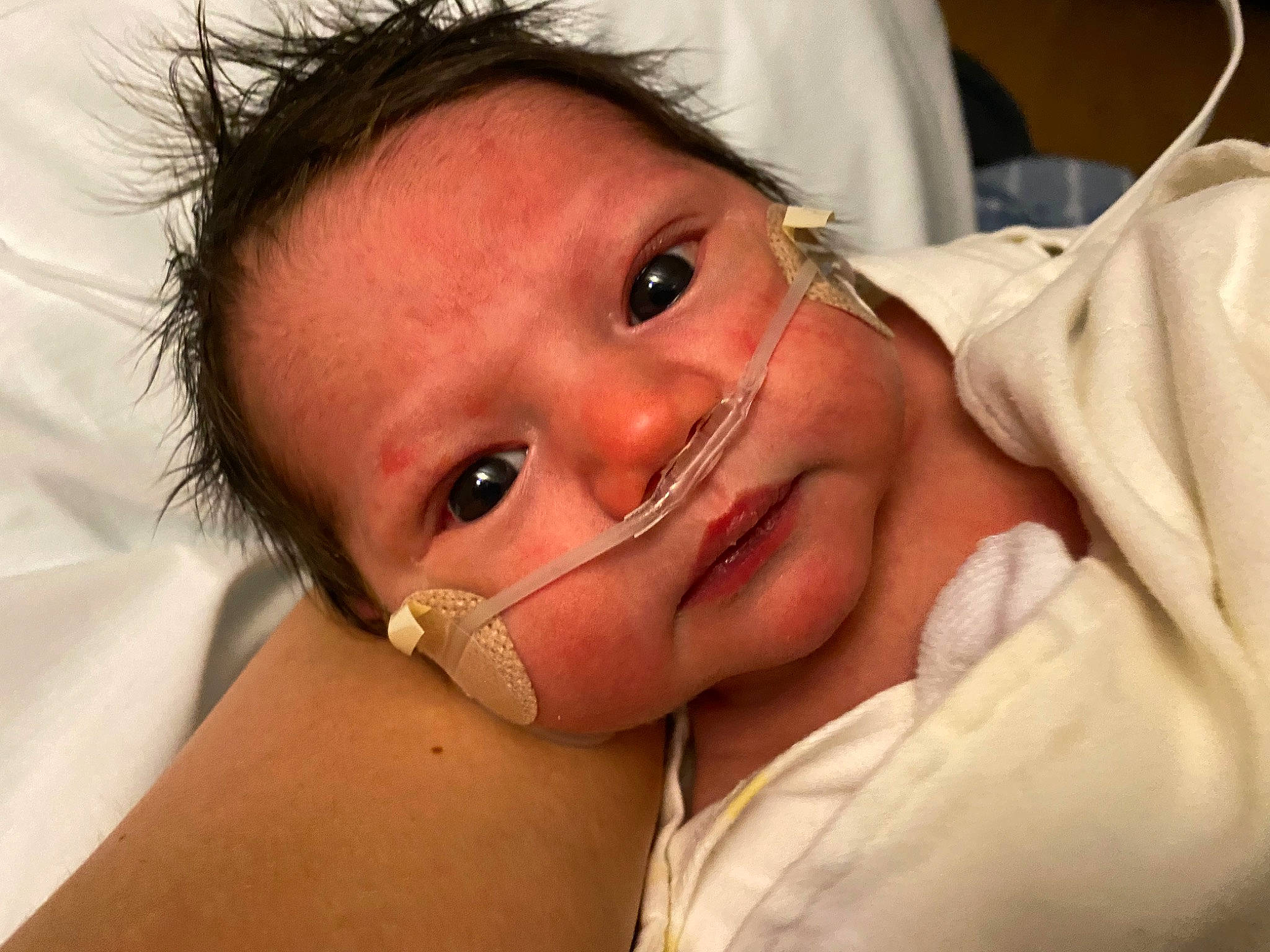 Brooks joined the competition — help win amazing prizes! baby, cheek, ear, eyebrow, eyelash, gesture, happy, health_care, jaw, lip, medical_equipment, mouth, nail, neck, nose, patient, person, skin, smile, thumb