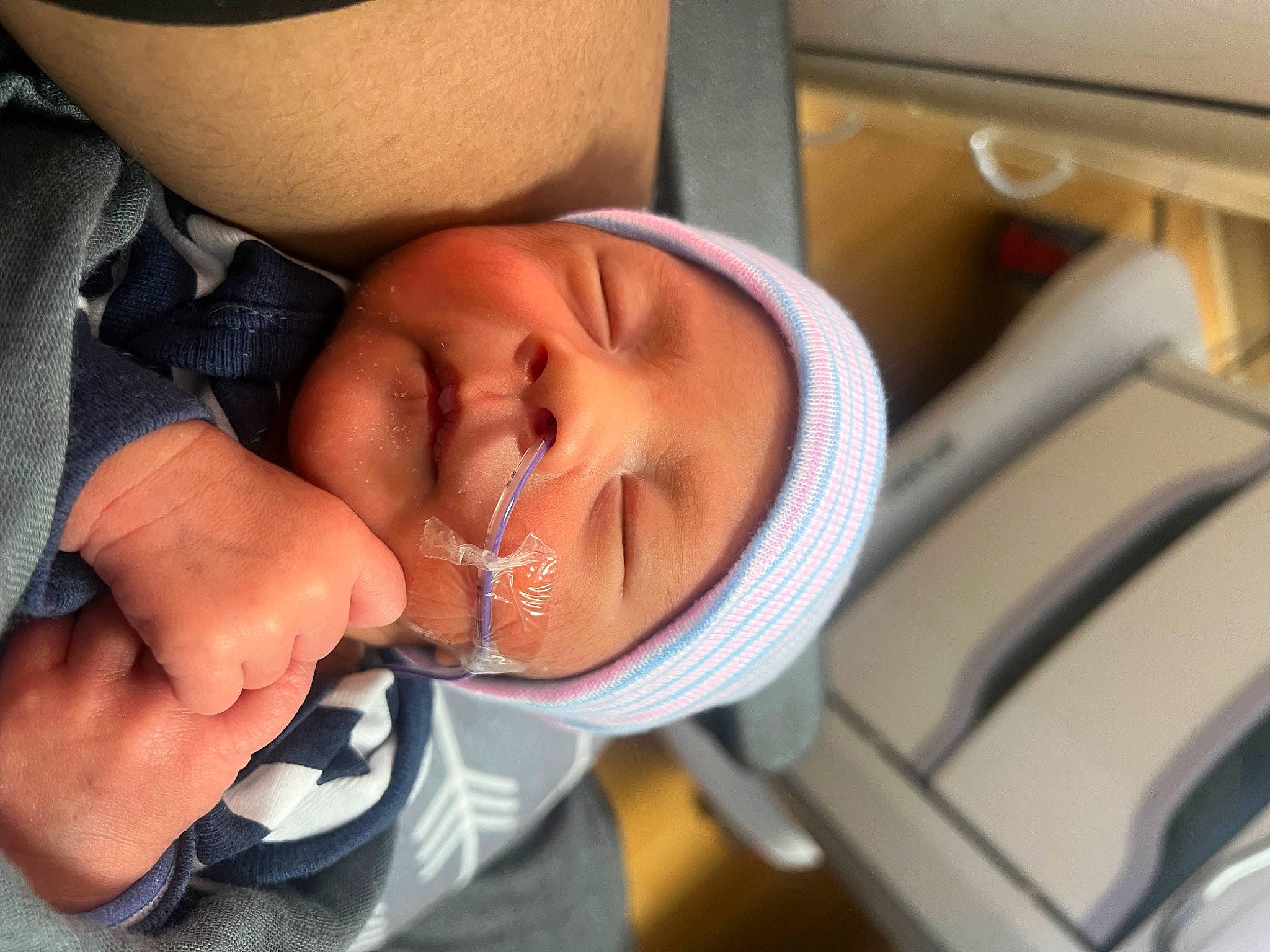 Deluca is registered to the contest to win money with this photo: baby, child, clothing, comfort, elbow, eyebrow, eyelash, finger, gesture, headwear, health_care, hospital, medical_equipment, mouth, nail, nose, person, service, skin, smile