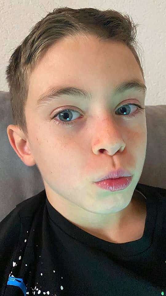 Alessio participe au concours pour gagner de l'argent avec cette photo : beauty, cheek, chin, close_up, ear, eye, eyebrow, eyelash, face, forehead, hair, hairstyle, head, jaw, lip, mouth, neck, nose, person, selfie