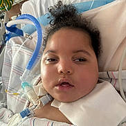 Jeremy joined the competition — help win amazing prizes! child, hospital, medical_tubes, bed, blanket, face, person, curly_hair, healthcare, patient, closeup, indoors, pediatric, medical_device, resting, serious, young, equipment, white_cloth, health