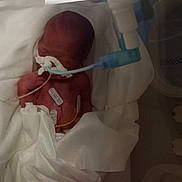 Ayden participe au concours pour gagner de l'argent avec cette photo : newborn, baby, incubator, hospital, nicu, premature_baby, medical_tube, oxygen_tube, adhesive_electrodes, monitoring_wires, swaddled, blanket, medical_equipment, patient, head, tiny, sleeping, healthcare, bed, wrapped