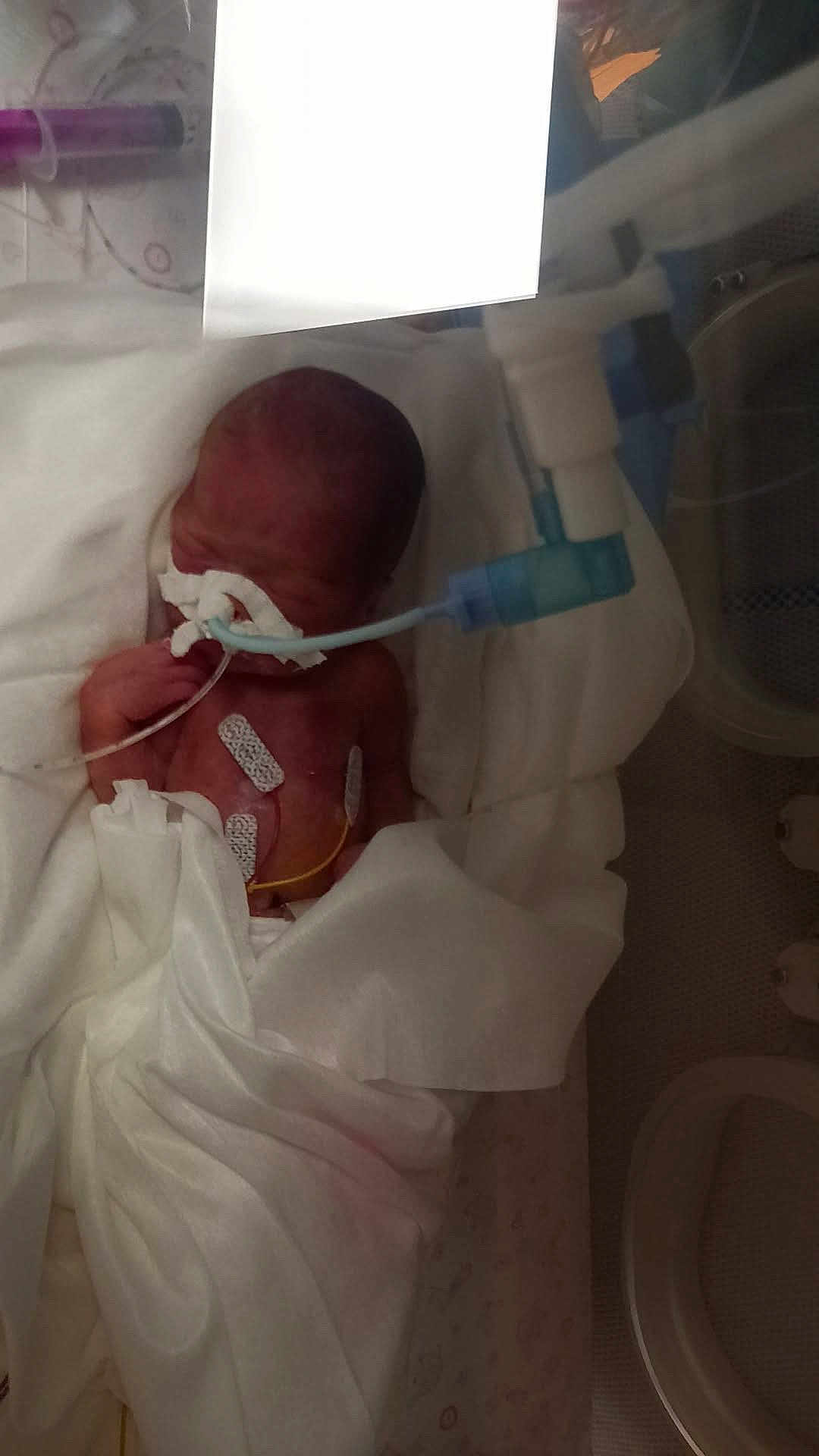 Ayden participe au concours pour gagner de l'argent avec cette photo : newborn, baby, incubator, hospital, nicu, premature_baby, medical_tube, oxygen_tube, adhesive_electrodes, monitoring_wires, swaddled, blanket, medical_equipment, patient, head, tiny, sleeping, healthcare, bed, wrapped