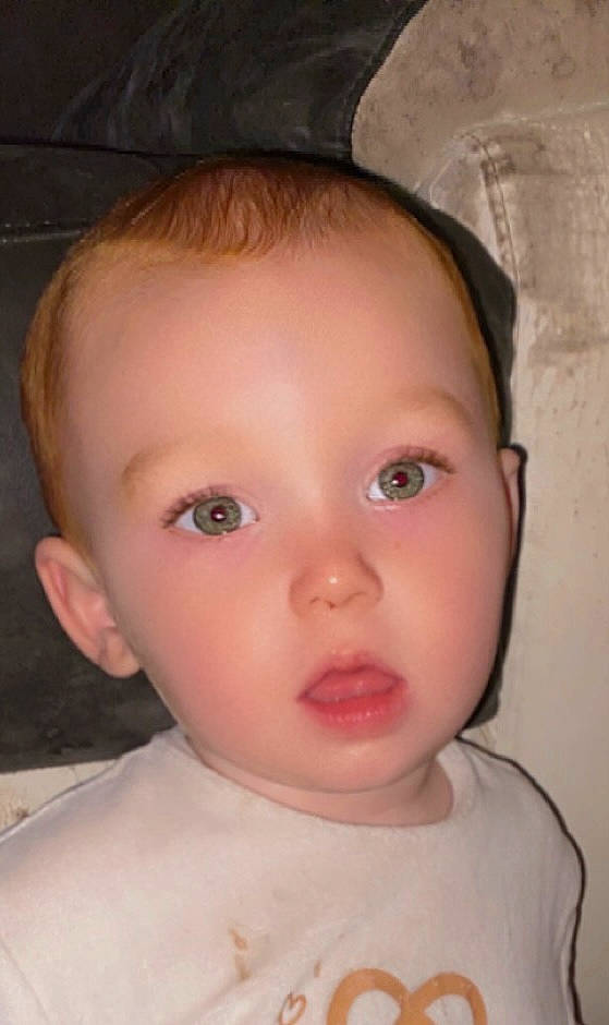 Celyan participe au concours pour gagner de l'argent avec cette photo : baby, baby_toddler_clothing, cheek, chin, dress, ear, eyebrow, eyelash, facial_expression, flash_photography, forehead, human_body, iris, lip, mouth, neck, no_expression, nose, person, skin