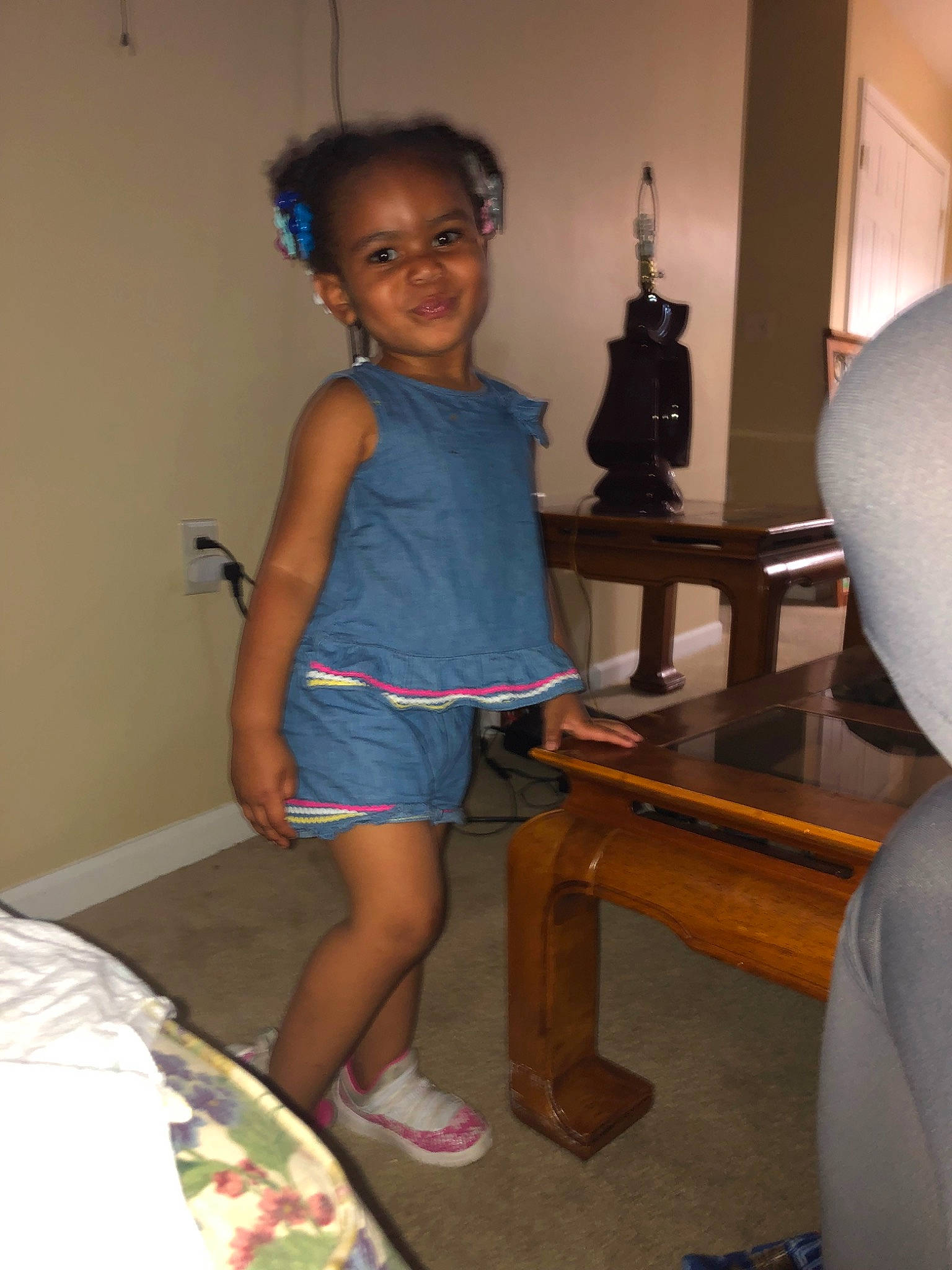 Laciana joined the competition — help win amazing prizes! arm, joint, leg, person, shoulder, thigh