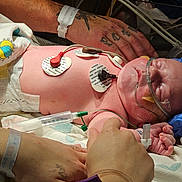 Nyx-Hemera is registered to the contest to win money with this photo: newborn, baby, hospital, medical, sensors, oxygen_tube, hand, tattoo, gloves, infant, care, patient, diaper, blanket, monitoring, healthcare, person, skin, treatment, bed