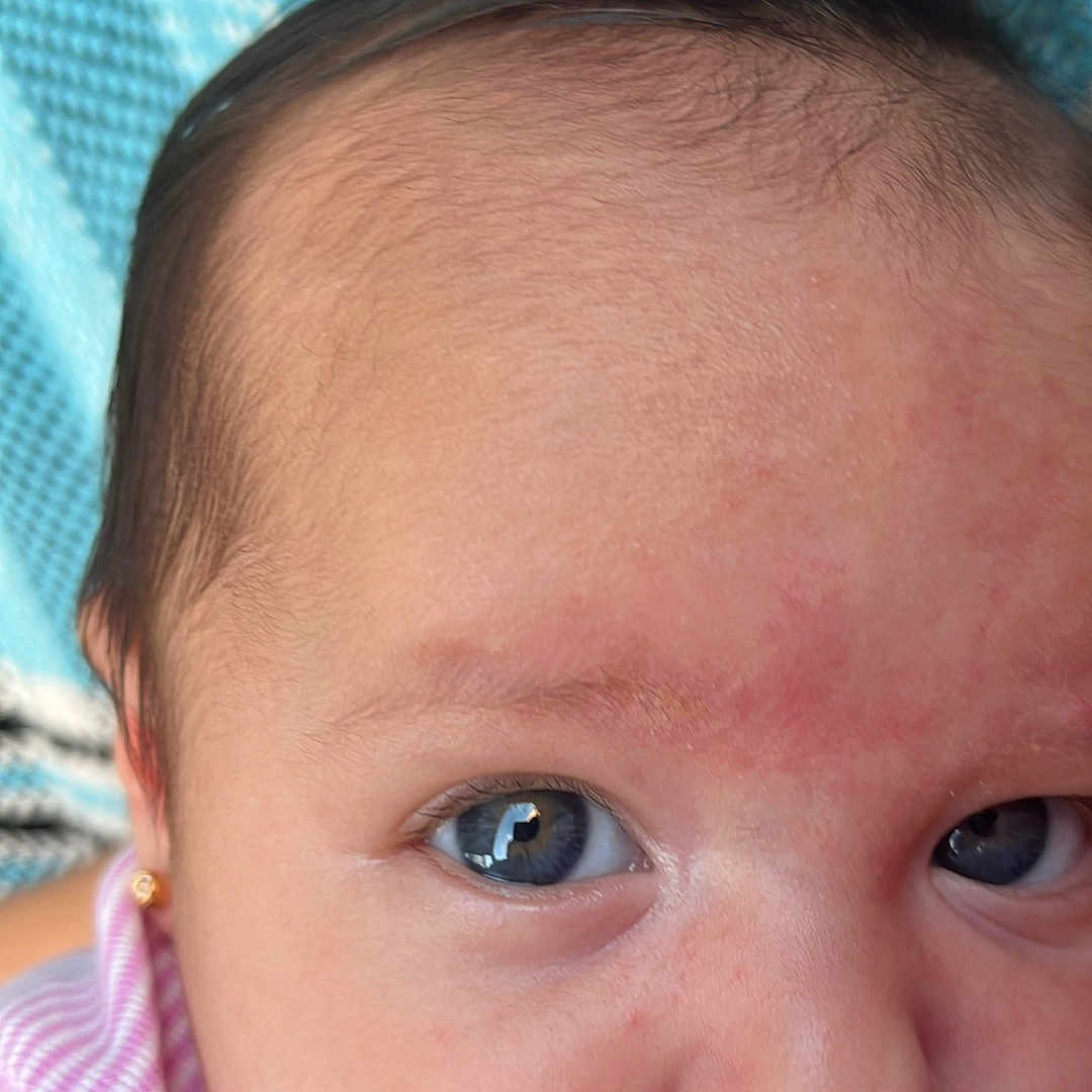 Isabella joined the competition — help win amazing prizes! baby, blue_eyes, child, close_up, cute, earring, expression, eyelashes, face, hand, human, infant, mouth, nose, person, pink_stripes, portrait, resting, skin, young