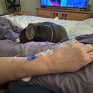 River is registered to the contest to win money with this photo: arm, bandage, bed, bedding, bedroom, blanket, brown_dog, collar, cozy, dog, furniture, home, indoors, pet, pillows, relaxation, remote_scene, resting, sleeping, television